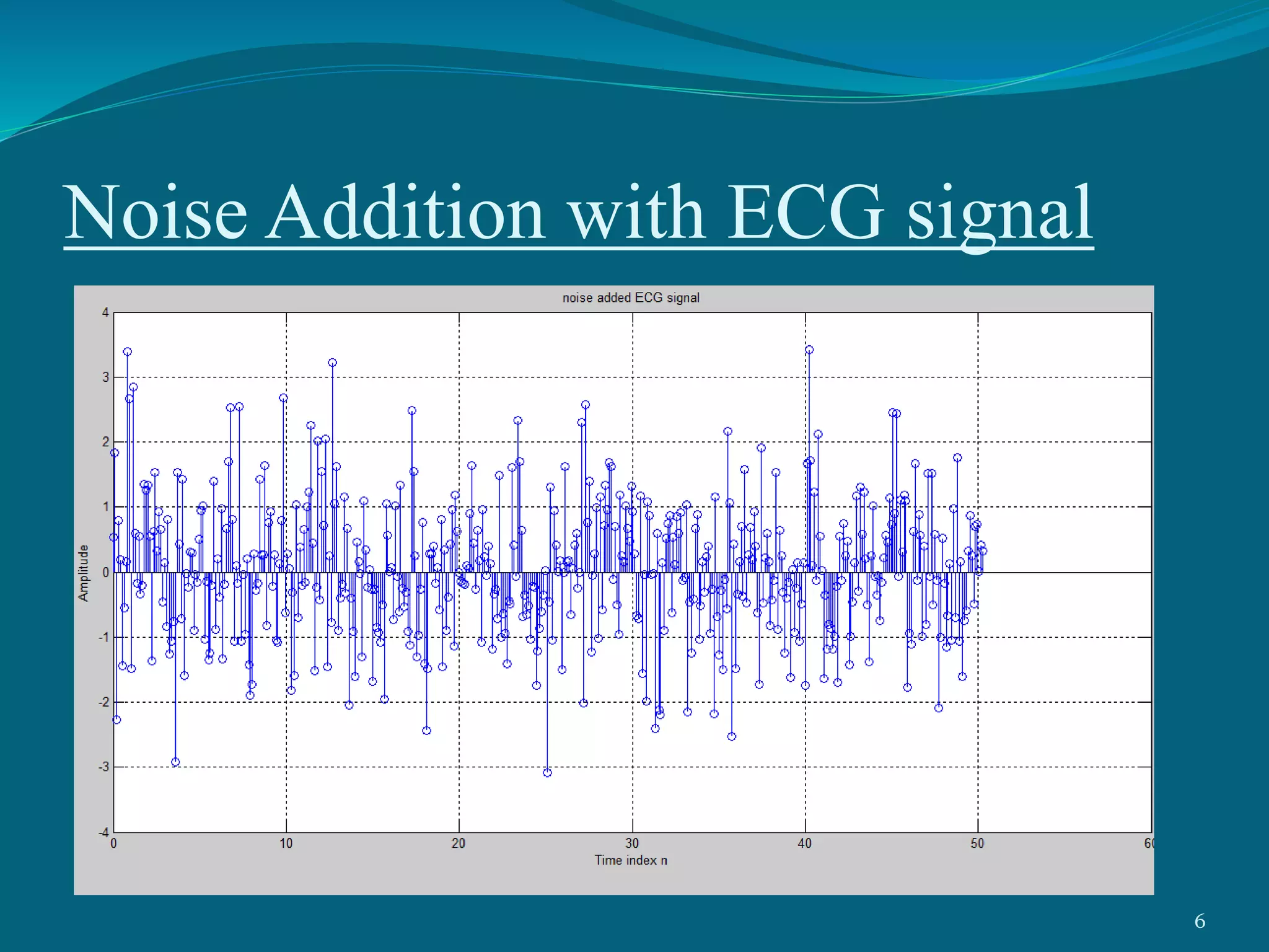 Noise Addition with ECG signal
6
 