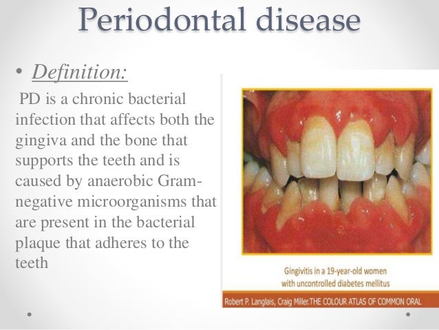 definition periodontal definition periodontal