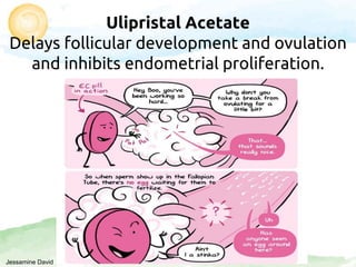 Ulipristal Acetate
Delays follicular development and ovulation
and inhibits endometrial proliferation.
Jessamine David
 