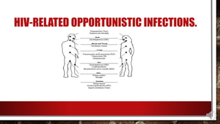 HIV-RELATED OPPORTUNISTIC INFECTIONS.
 
