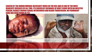CAUSED BY THE HUMAN IMMUNO-DEFICIENCY VIRUS OR THE HIV, AIDS IS ONE OF THE MOST
DEADLIEST DISEASES OF ALL TIME. ITS CAUSED BY EXCHANGE OF BODY FLUIDS WITH AN INFECTED
PERSON, USUALLY DURING SEXUAL INTERCOURSE AND BLOOD TRANSFUSION. NO PERMANENT
CURE HAS BEEN FOUND AS YET.
 