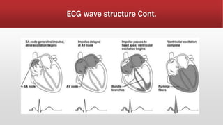 ECG wave structure Cont.
 
