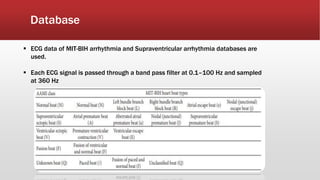 Database
 ECG data of MIT-BIH arrhythmia and Supraventricular arrhythmia databases are
used.
 Each ECG signal is passed through a band pass filter at 0.1–100 Hz and sampled
at 360 Hz
 