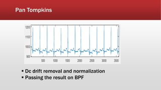 Pan Tompkins
 Dc drift removal and normalization
 Passing the result on BPF
 