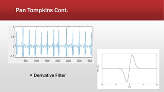 Pan Tompkins Cont.
 Derivative Filter
 