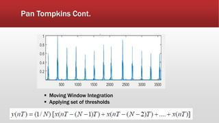 Pan Tompkins Cont.
 Moving Window Integration
 Applying set of thresholds
 