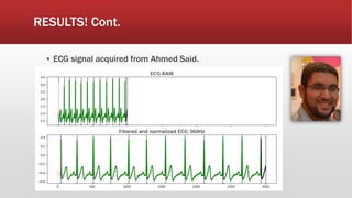 RESULTS! Cont.
▪ ECG signal acquired from Ahmed Said.
 