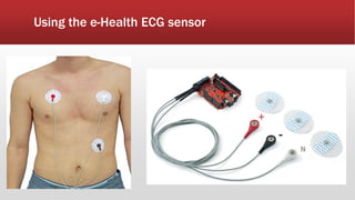 Using the e-Health ECG sensor
 