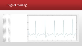 Signal reading
 
