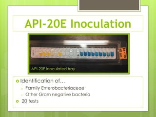 Isolation of Clostridium | PPTX | Infectious Diseases | Diseases and ...