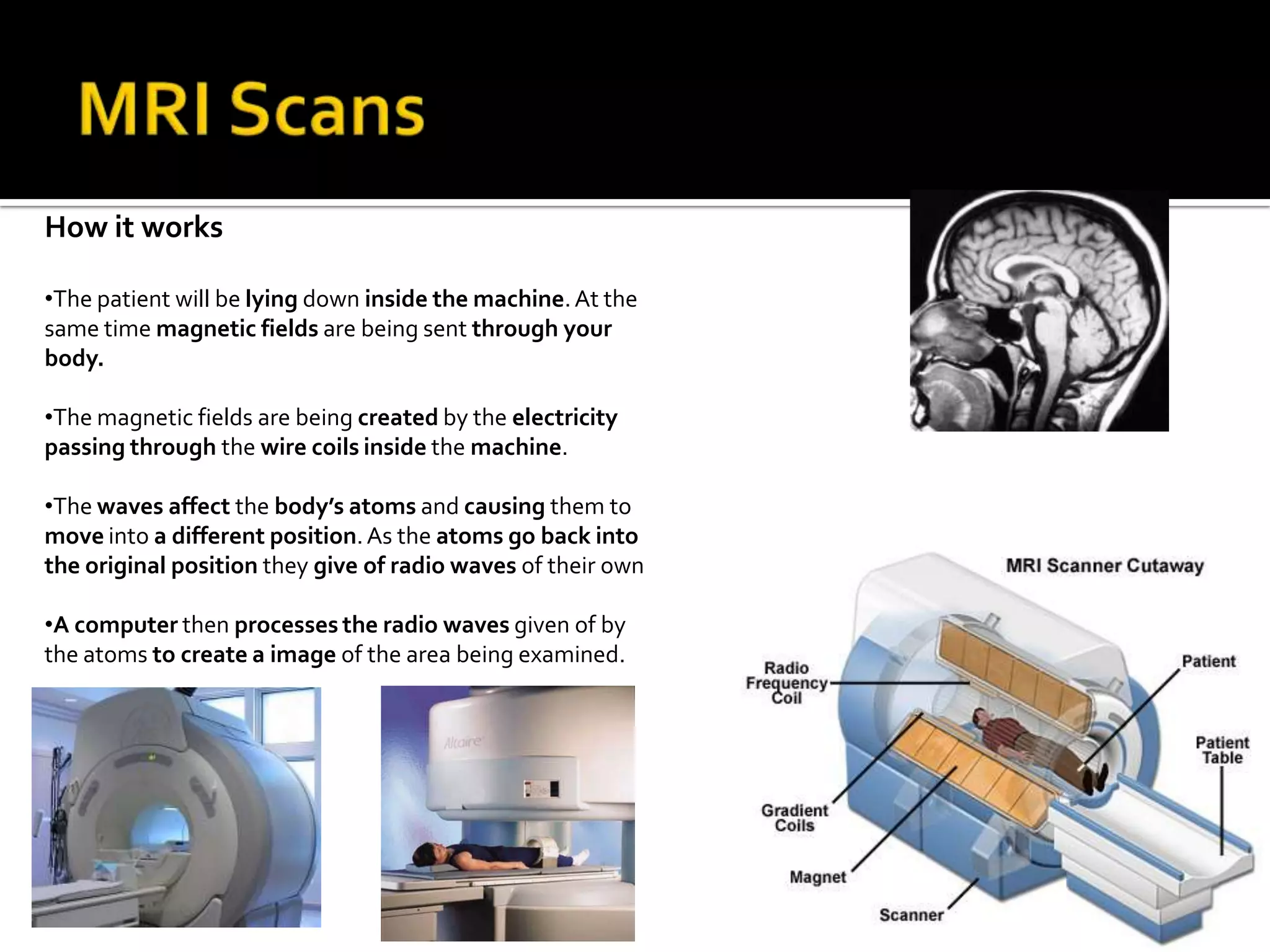 CT examinations could also be used to plan for surgeries such as, organ transplants.Benefits Vs. Risks of CT ScansBenefits Vs. Risks of CT ScansRISKSBenefitsRISKSBenefitsCT scanning are painless