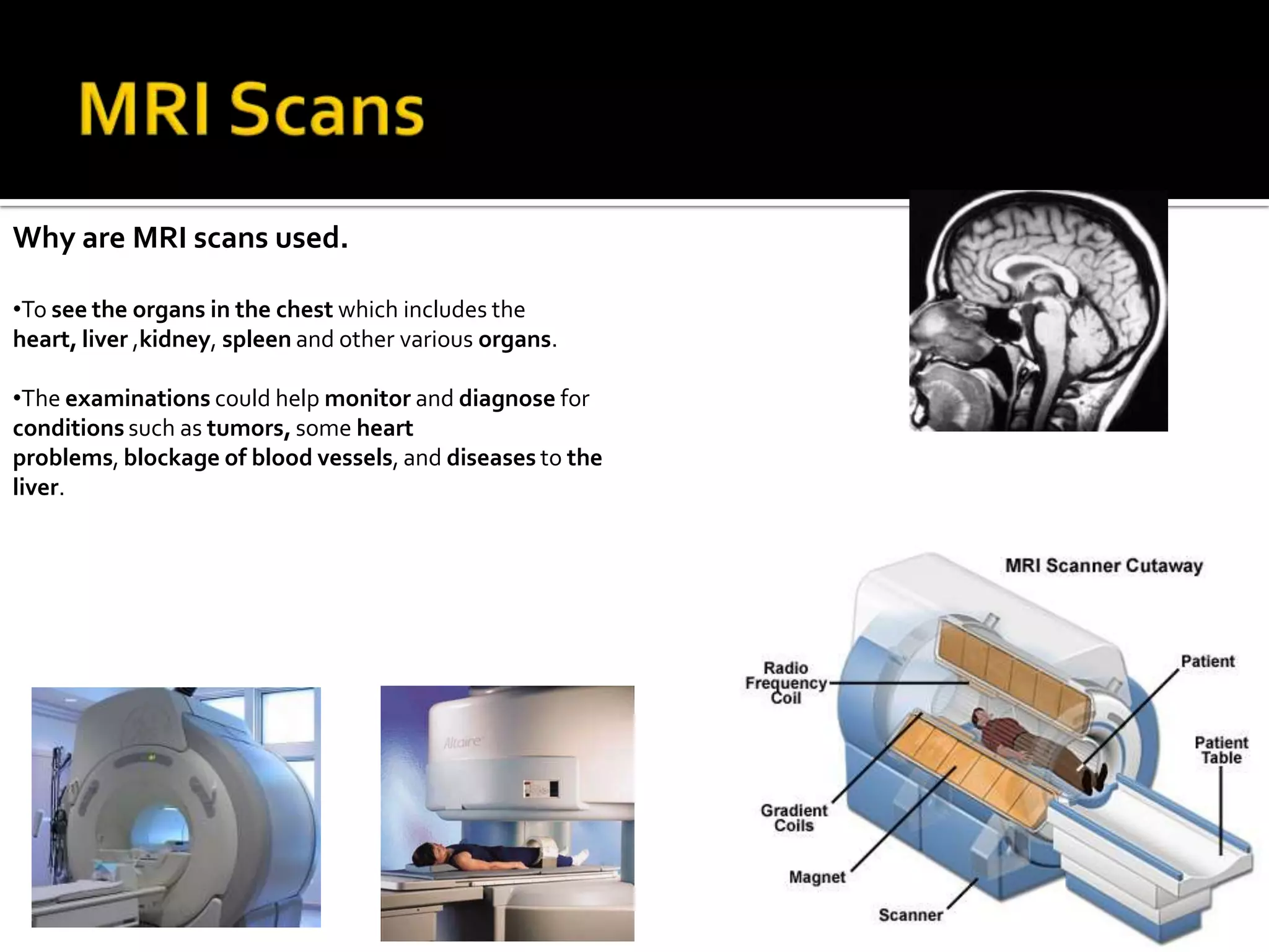 It can image bones, soft tissues and blood vessels at the same time.