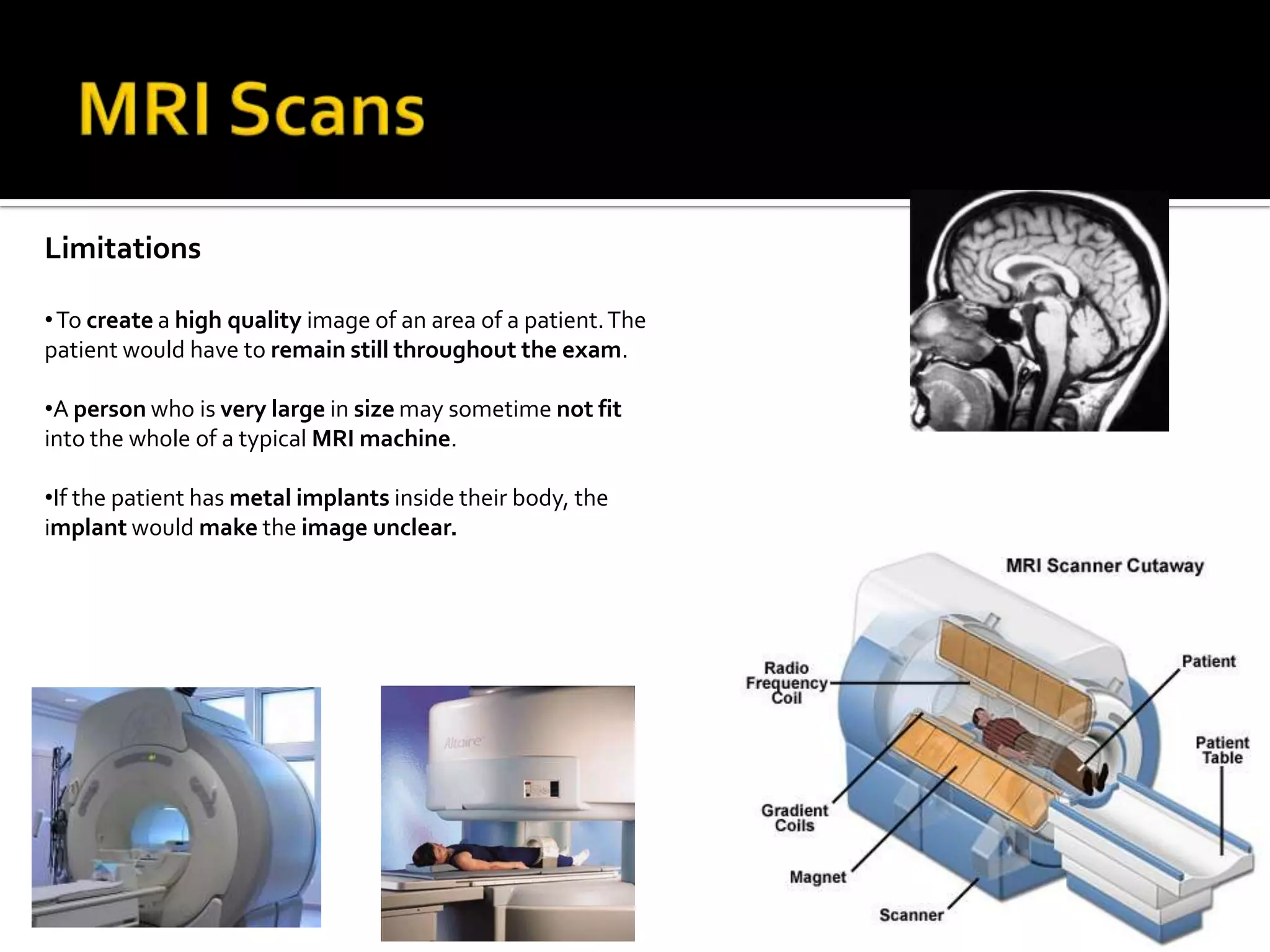 CT scanning are very fast and simple.