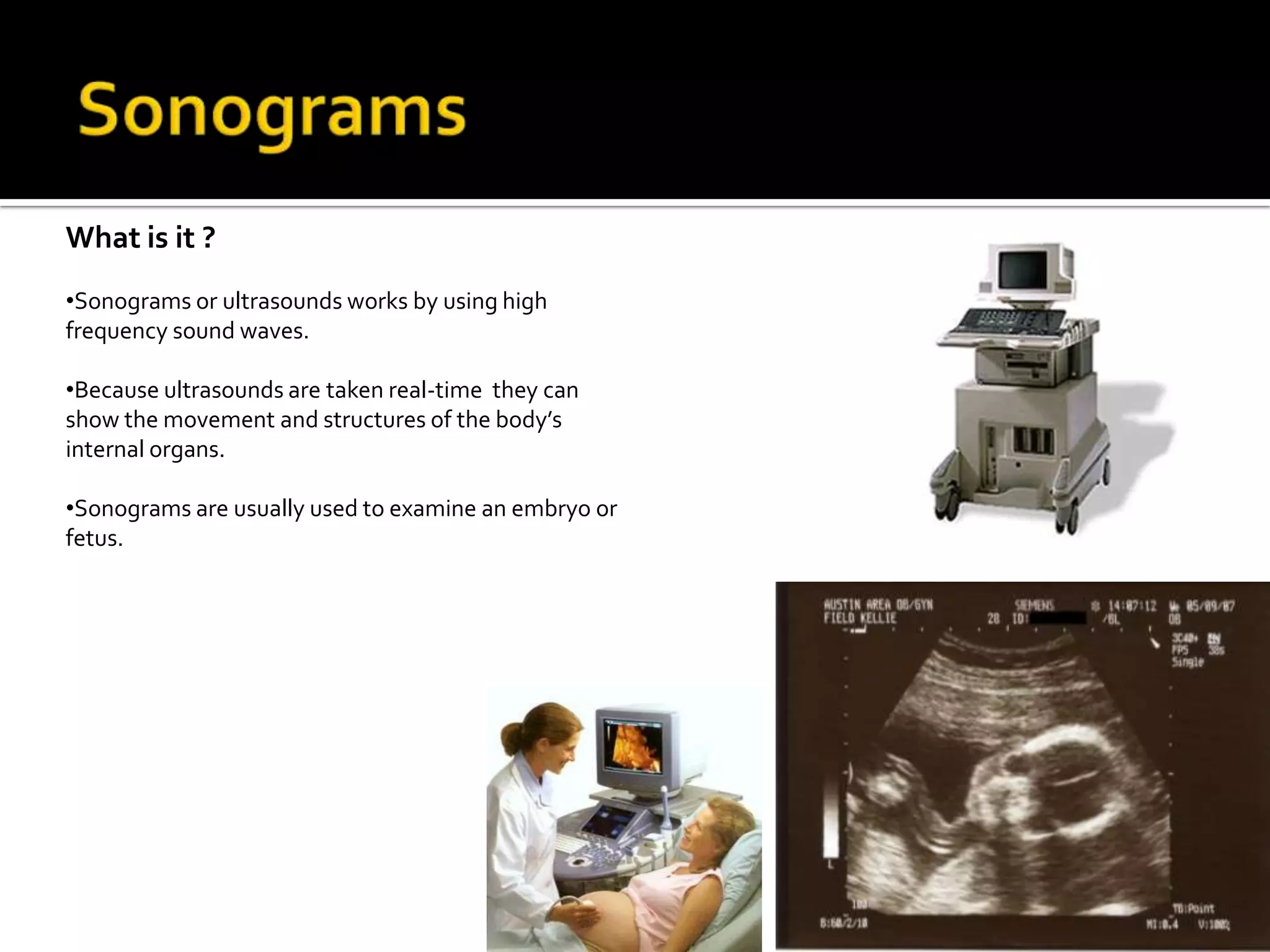No radiation remains inside the patient after the examination.