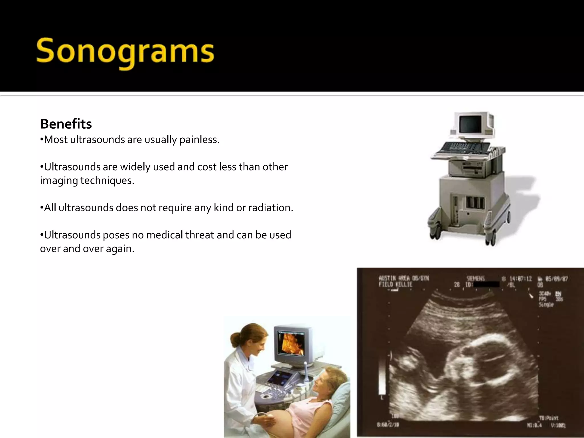 The amount of radiation from one exam in the CT scan is around the same amount that you would receive in 3 top five years.