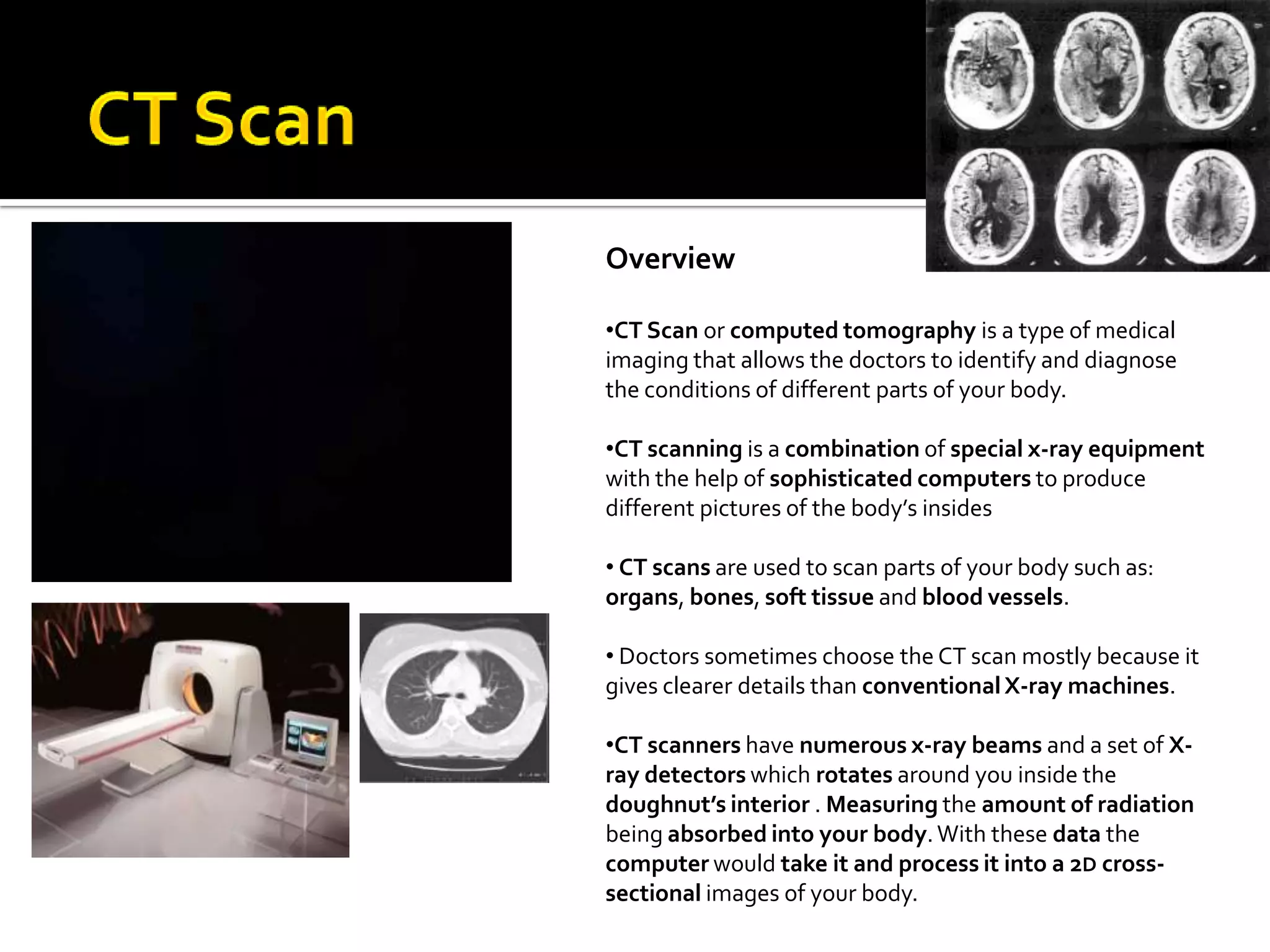 CT Scan OverviewCT Scan or computed tomography is a type of medical  imaging that allows the doctors to identify and diagnose the conditions of different parts of your body.