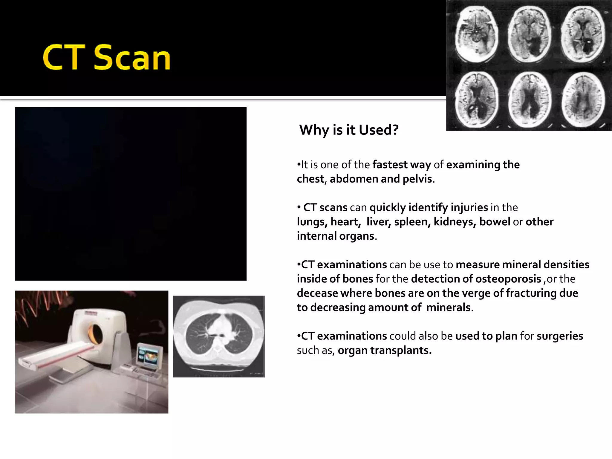CT scanning is a combination of special x-ray equipment with the help of sophisticated computers to produce different pictures of the body’s insides
