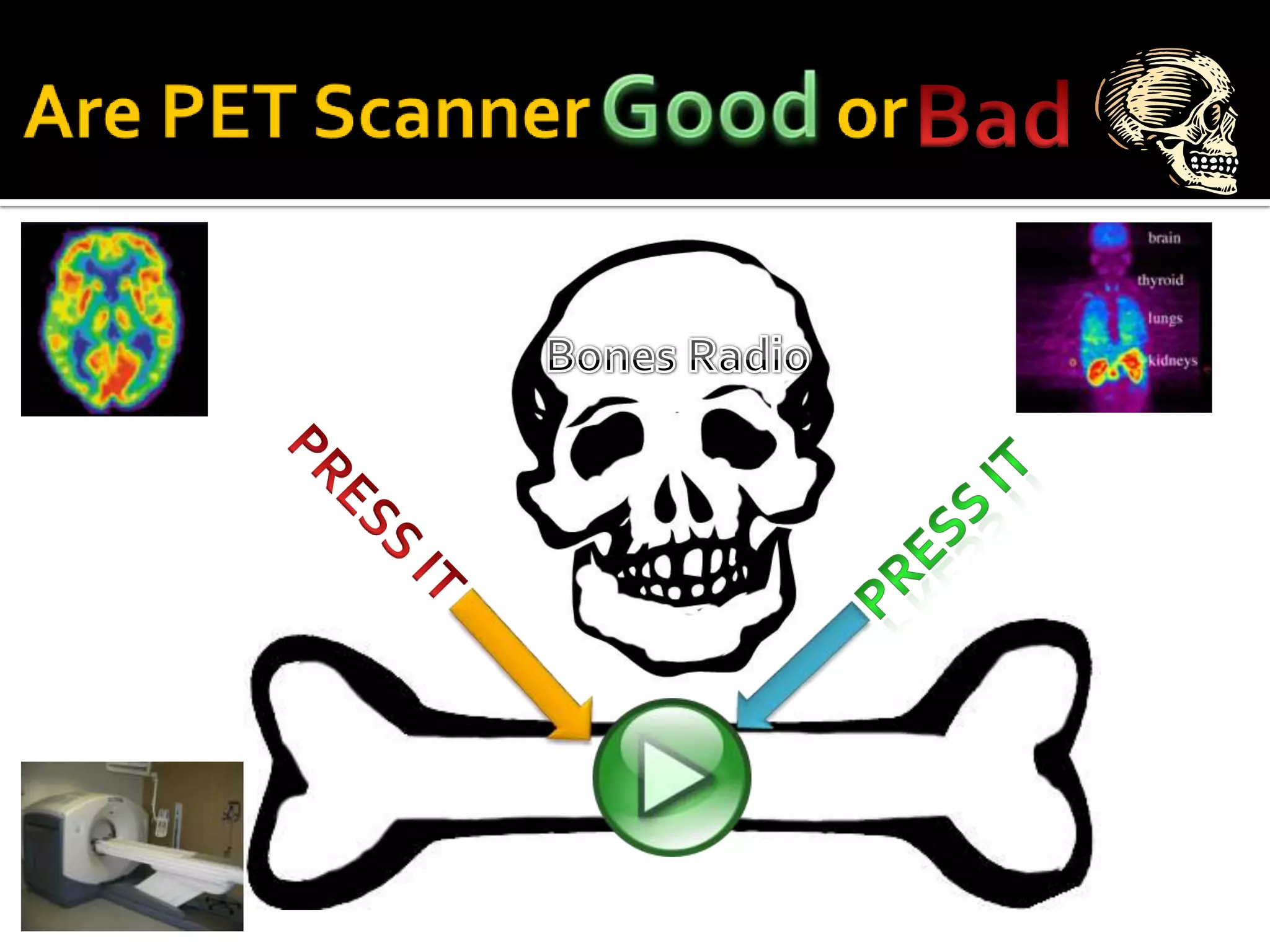 CT examinations can be use to measure mineral densities inside of bones for the detection of osteoporosis ,or the decease where bones are on the verge of fracturing due to decreasing amount of  minerals. 