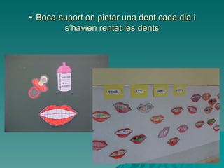 -  Boca-suport on pintar una dent cada dia i s’havien rentat les dents 
