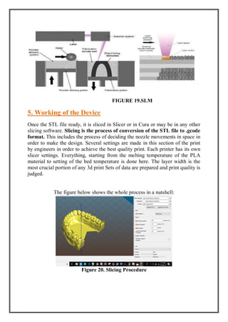 FIGURE 19.SLM
5. Working of the Device
Once the STL file ready, it is sliced in Slicer or in Cura or may be in any other
slicing software. Slicing is the process of conversion of the STL file to .gcode
format. This includes the process of deciding the nozzle movements in space in
order to make the design. Several settings are made in this section of the print
by engineers in order to achieve the best quality print. Each printer has its own
slicer settings. Everything, starting from the melting temperature of the PLA
material to setting of the bed temperature is done here. The layer width is the
most crucial portion of any 3d print Sets of data are prepared and print quality is
judged.
The figure below shows the whole process in a nutshell:
Figure 20. Slicing Procedure
 