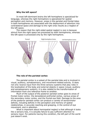 Why the left space?
In most left-dominant brains the left hemisphere is specialized for
language, whereas the right hemisphere is specialized for spatial
perception and memory. However, areas in the parietal and frontal lobes
in both hemispheres are associated with the deployment of attention into
contralateral space and damage to the right ones results as a neglect of
the left space.
The reason that the right-sided spatial neglect is rare is because
stimuli from the right space are processed by both hemispheres, whereas
the left space is processed only by the right hemisphere.
The role of the parietal cortex
The parietal cortex is a subset of the parietal lobe and is involved in
visual, auditory, somatosensory, and movement-related activity. It does
not only receive input from the three sensory systems that play roles in
the localization of the body and external objects in space (visual, auditory
and somatosensory system), it is also related to the transformation of
information from one reference frame to another.
Much of the output of the posterior parietal cortex goes to areas of
frontal motor cortex: the dorsolateral prefrontal cortex, various areas of
the secondary motor cortex, and the frontal eye field. Damage to the area
of the posterior parietal cortex can produce a variety of sensorimotor
deficits, including deficits in the perception and memory of spatial
relationships, in accurate reaching and grasping, in the control of eye
movement, and in attention.
What is important about hemispatial neglect is that although it looks
like a sensory loss, it is actually failure to pay sufficient attention to
sensory input. For patients having this condition, the left part of the world
just doesn’t exist.
 