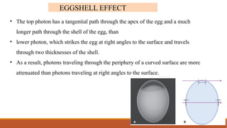 Comprehensive Overview of Projection Geometry in Dental Radiography | PPTX