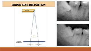 Size Distortion Radiograph Comprehensive Guide to Dental Projection Geometry and Radiographic ...