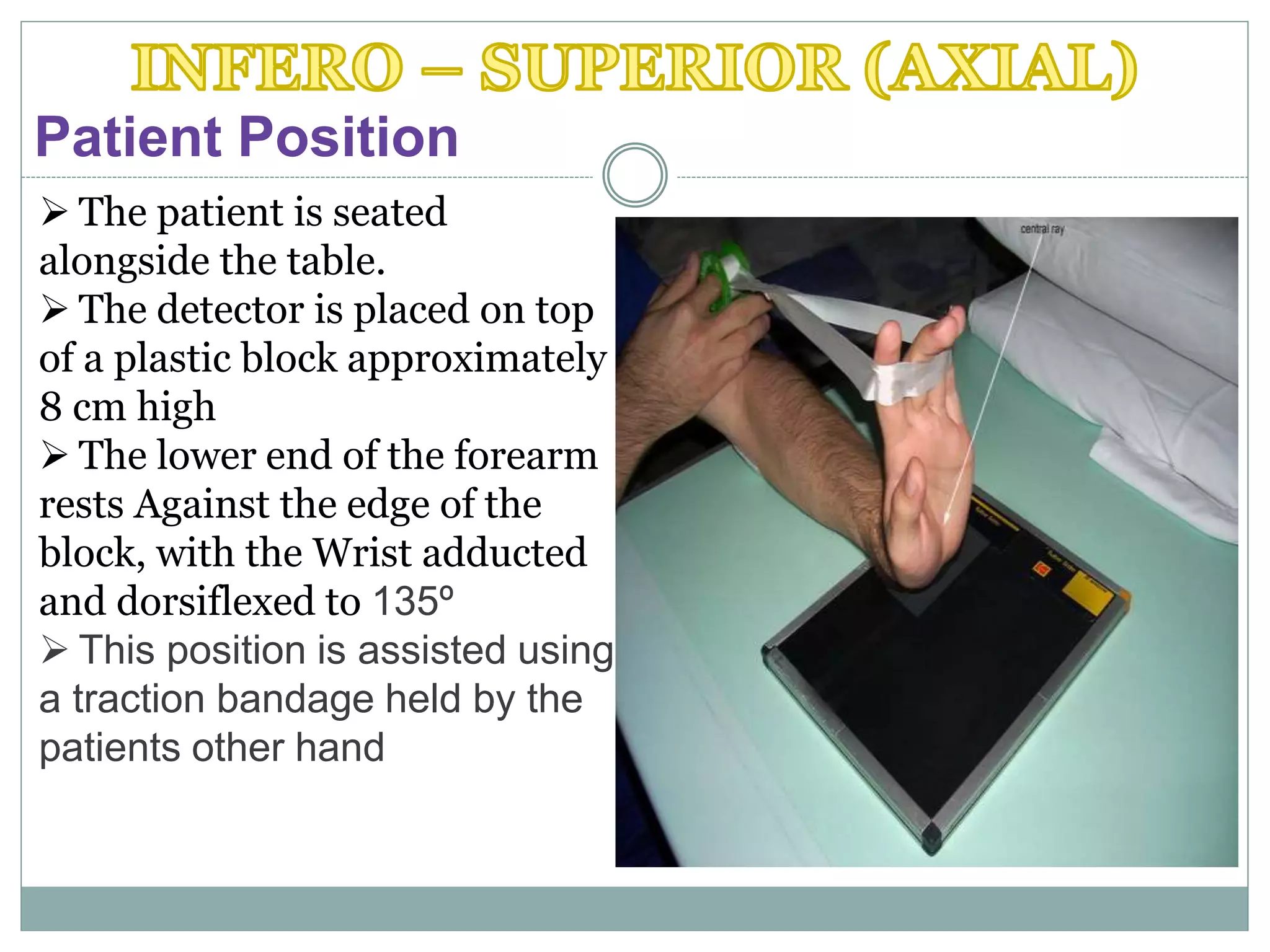 Patient Position
 The patient is seated
alongside the table.
 The detector is placed on top
of a plastic block approximately
8 cm high
 The lower end of the forearm
rests Against the edge of the
block, with the Wrist adducted
and dorsiflexed to 135º
 This position is assisted using
a traction bandage held by the
patients other hand
 