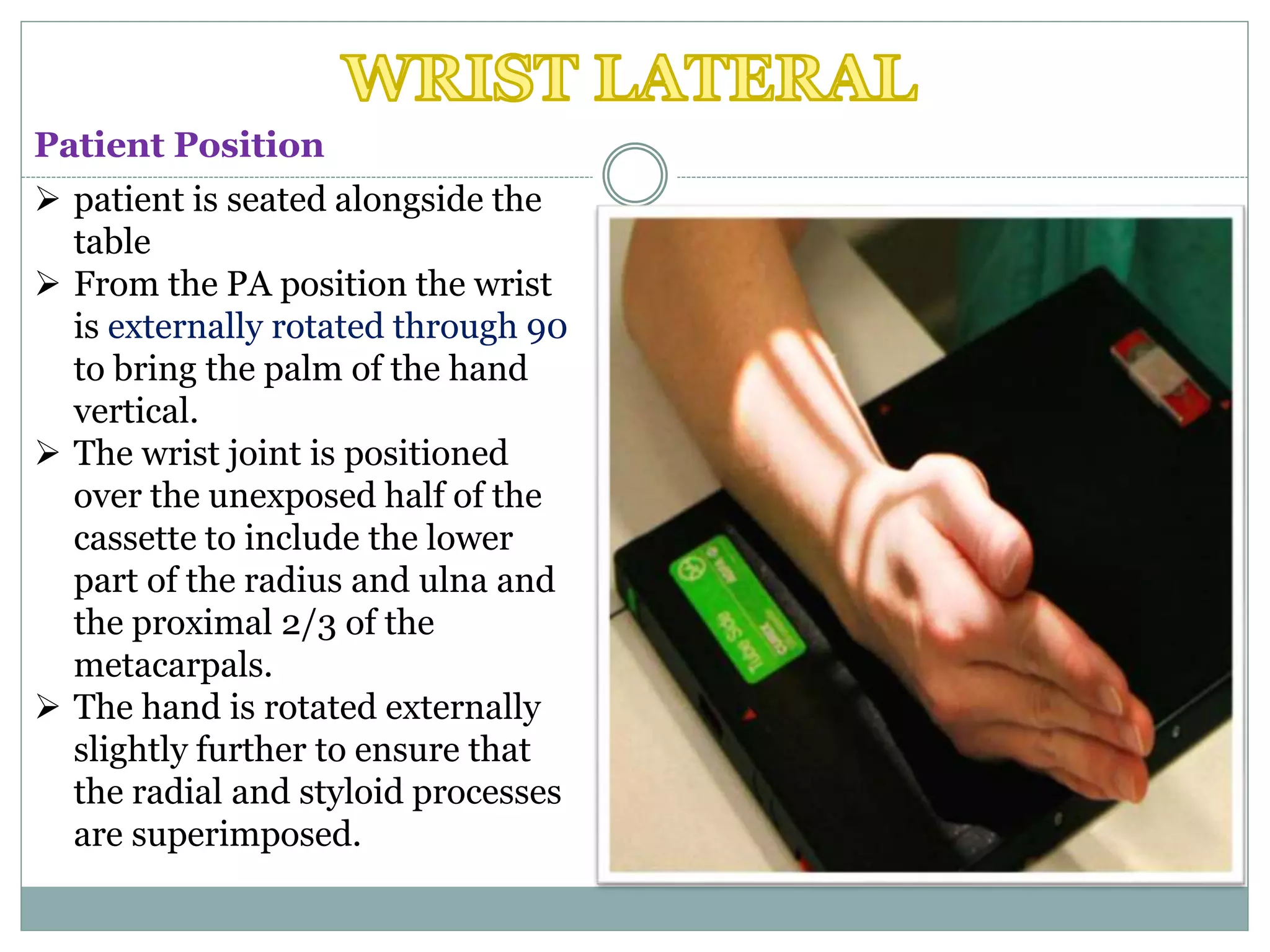  patient is seated alongside the
table
 From the PA position the wrist
is externally rotated through 90
to bring the palm of the hand
vertical.
 The wrist joint is positioned
over the unexposed half of the
cassette to include the lower
part of the radius and ulna and
the proximal 2/3 of the
metacarpals.
 The hand is rotated externally
slightly further to ensure that
the radial and styloid processes
are superimposed.
Patient Position
 