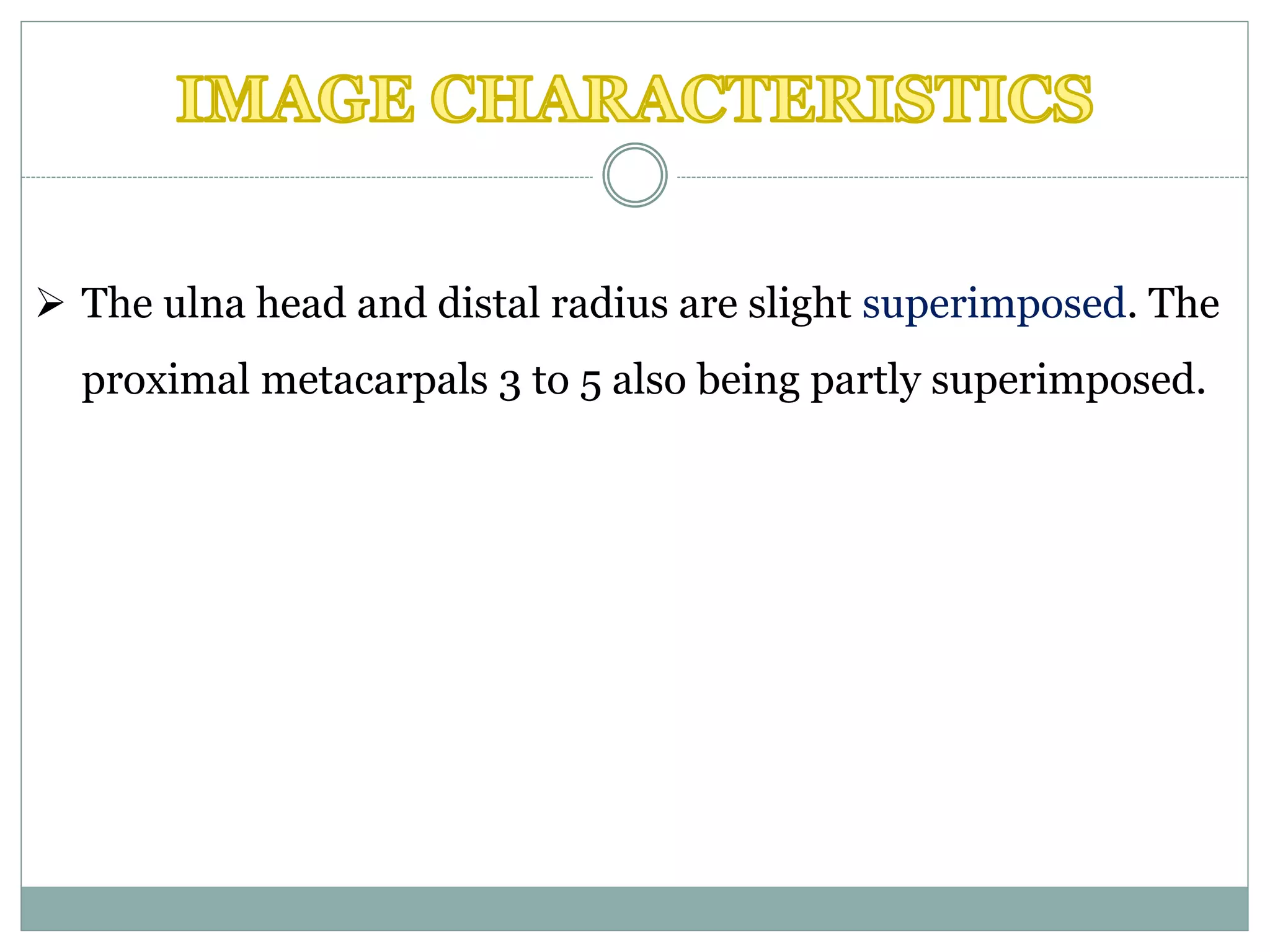  The ulna head and distal radius are slight superimposed. The
proximal metacarpals 3 to 5 also being partly superimposed.
 