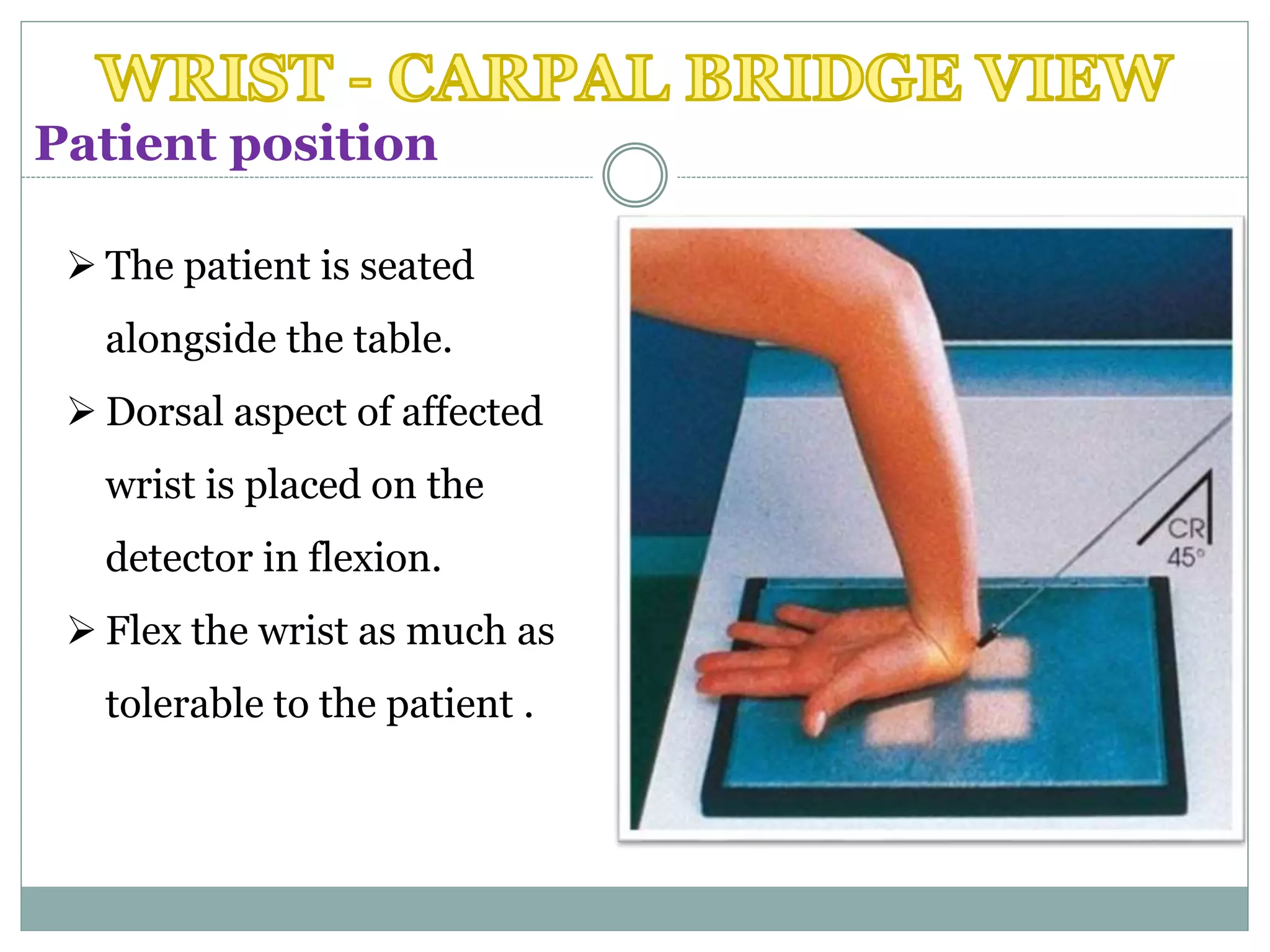  The patient is seated
alongside the table.
 Dorsal aspect of affected
wrist is placed on the
detector in flexion.
 Flex the wrist as much as
tolerable to the patient .
Patient position
 