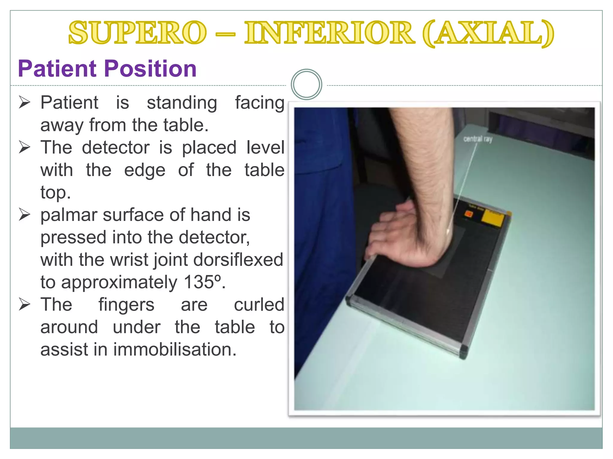  Patient is standing facing
away from the table.
 The detector is placed level
with the edge of the table
top.
 palmar surface of hand is
pressed into the detector,
with the wrist joint dorsiflexed
to approximately 135º.
 The fingers are curled
around under the table to
assist in immobilisation.
Patient Position
 