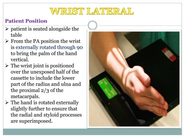 Projections of carpal tunnel and wrist | PPTX | Death, Injury, or ...