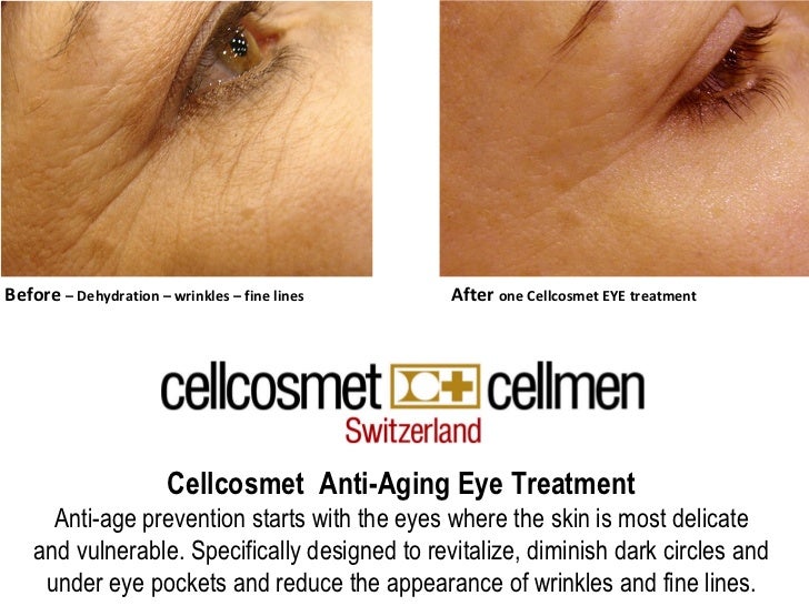 cellcosmet eye cream