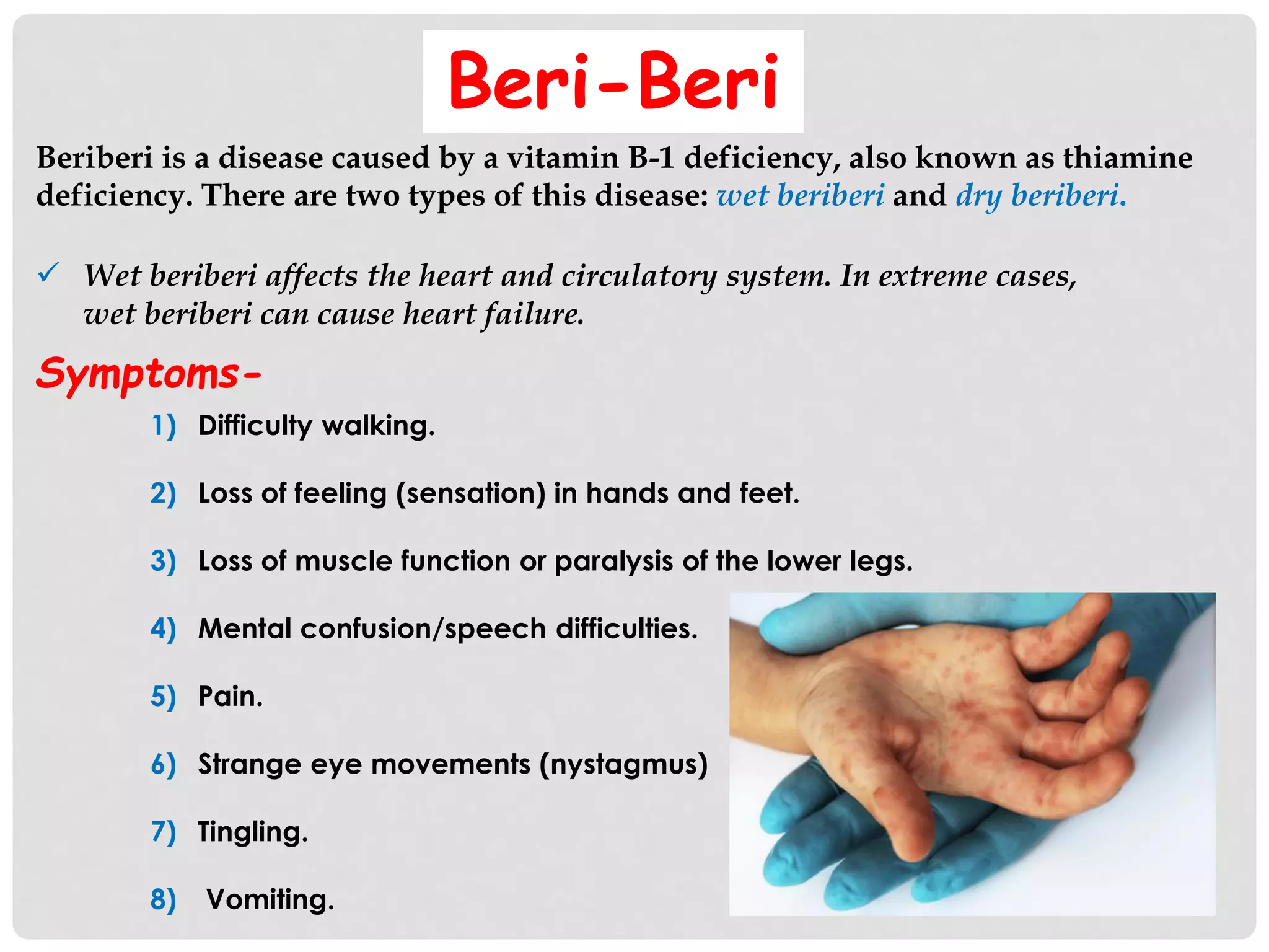 project-on-deficiency-diseases-by-naisha-beri-class-5-a-pdf