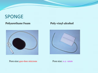 SPONGE
Polyurethane Foam Poly-vinyl-alcohol
Pore size:400-600 microns Pore size: 0.2 -1mm
 