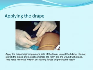Applying the drape
Apply the drape beginning on one side of the foam, toward the tubing. Do not
stretch the drape and do not compress the foam into the wound with drape.
This helps minimize tension or shearing forces on periwound tissue
 