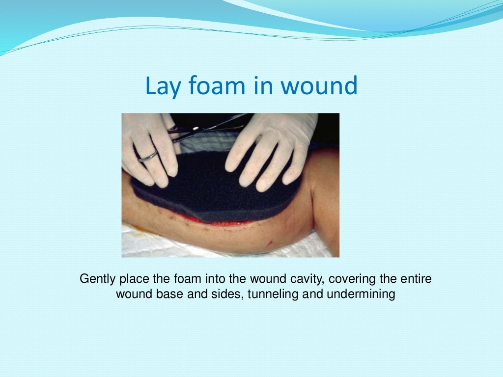 VACUUM ASSISTED WOUND THERAPY