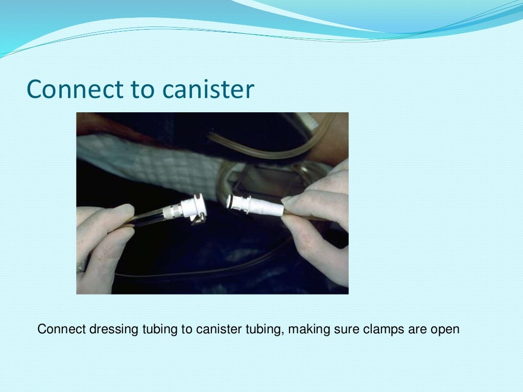 VACUUM ASSISTED WOUND THERAPY