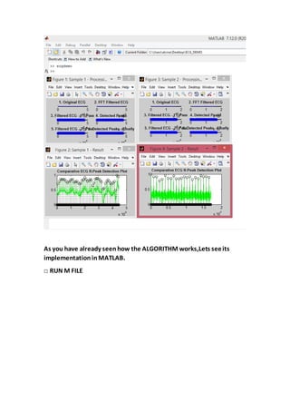 As you have already seenhow the ALGORITHM works,Lets seeits
implementationinMATLAB.
□ RUN M FILE
 