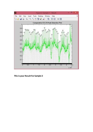 This is your Result For Sample 2
 