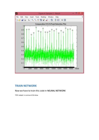 TRAIN NETWORK
Now we have to train this code in NEURAL NETWORK
TYPE nntool in command Window
 