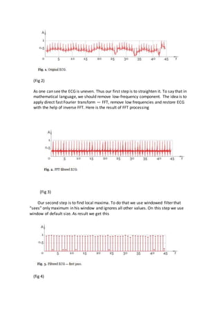 (Fig 2)
As one can see the ECG is uneven. Thus our first step is to straighten it. To say that in
mathematical language, we should remove low-frequency component. The idea is to
apply direct fast Fourier transform — FFT, remove low frequencies and restore ECG
with the help of inverse FFT. Here is the result of FFT processing
(Fig 3)
Our second step is to find local maxima. To do that we use windowed filter that
“sees” only maximum in his window and ignores all other values. On this step we use
window of default size. As result we get this
(fig 4)
 