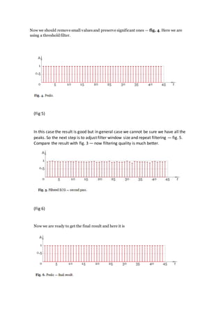 Now we should remove small valuesand preserve significant ones — fig. 4. Here we are
using a threshold filter.
(Fig 5)
In this case the result is good but in general case we cannot be sure we have all the
peaks. So the next step is to adjust filter window size and repeat filtering — fig. 5.
Compare the result with fig. 3 — now filtering quality is much better.
(Fig 6)
Now we are ready to get the final result and here it is
 