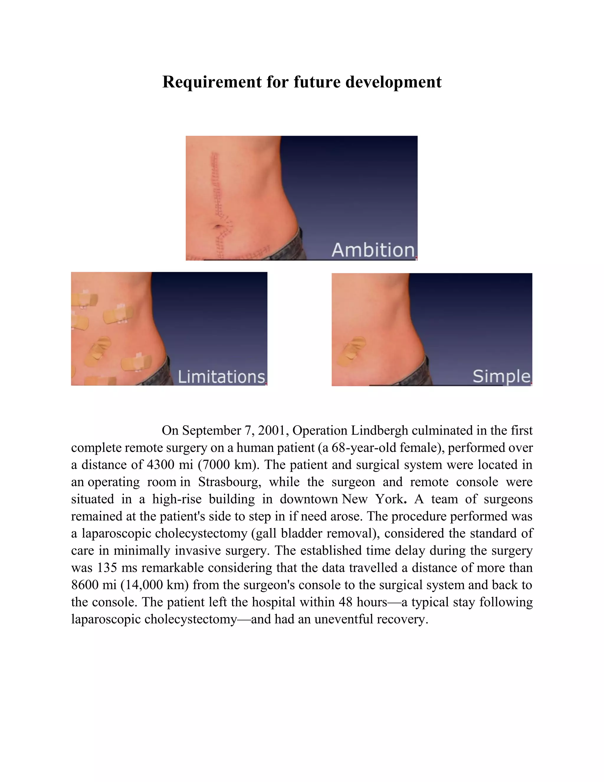 Requirement for future development
On September 7, 2001, Operation Lindbergh culminated in the first
complete remote surgery on a human patient (a 68-year-old female), performed over
a distance of 4300 mi (7000 km). The patient and surgical system were located in
an operating room in Strasbourg, while the surgeon and remote console were
situated in a high-rise building in downtown New York. A team of surgeons
remained at the patient's side to step in if need arose. The procedure performed was
a laparoscopic cholecystectomy (gall bladder removal), considered the standard of
care in minimally invasive surgery. The established time delay during the surgery
was 135 ms remarkable considering that the data travelled a distance of more than
8600 mi (14,000 km) from the surgeon's console to the surgical system and back to
the console. The patient left the hospital within 48 hours—a typical stay following
laparoscopic cholecystectomy—and had an uneventful recovery.
 