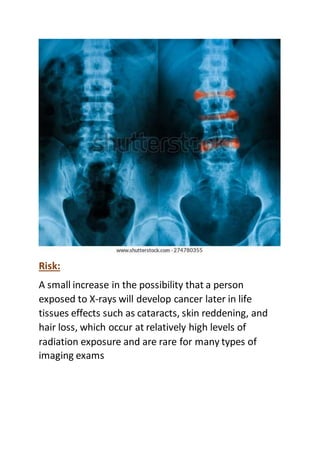 Risk:
A small increase in the possibility that a person
exposed to X-rays will develop cancer later in life
tissues effects such as cataracts, skin reddening, and
hair loss, which occur at relatively high levels of
radiation exposure and are rare for many types of
imaging exams
 