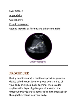 Liver disease
Appendicitis
Ovarian cysts
Ectopic pregnancy
Uterine growths or fibroids and other conditions
PROCEDURE
During an ultrasound, a healthcare provider passes a
device called a transducer or probe over an area of
your body or inside a body opening. The provider
applies a thin layer of gel to your skin so that the
ultrasound waves are transmitted from the transducer
through the gel and into your body.
 