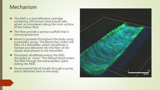 Bioartificial Kidney Project skt dr keniz | PPTX