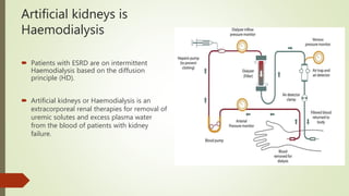 Bioartificial Kidney Project – Portable, wearable and implantable ...