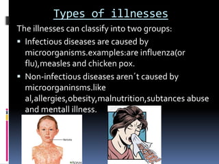 Types of illnesses
The illnesses can classify into two groups:
 Infectious diseases are caused by
  microorganisms.examples:are influenza(or
  flu),measles and chicken pox.
 Non-infectious diseases aren´t caused by
  microorganinsms.like
  al,allergies,obesity,malnutrition,subtances abuse
  and mentall illness.
 